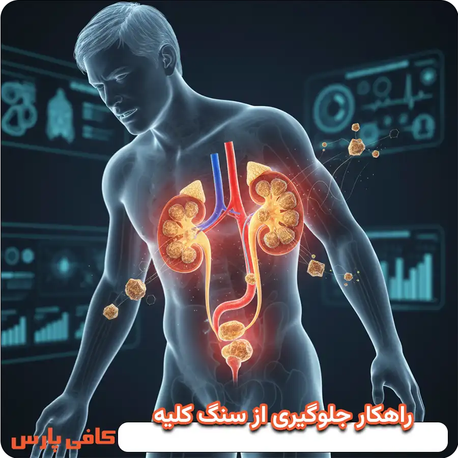 راهکار های مهم برای جلوگیری از سنگ کلیه